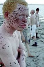 Watch Albino United Megashare