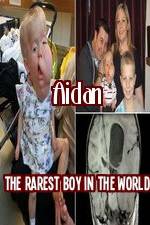 Watch Aidan The Rarest Boy In The World Megashare