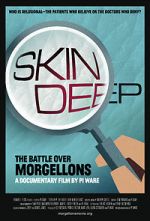 Watch Skin Deep: The Battle Over Morgellons Megashare