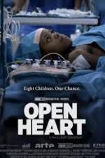 Watch Open Heart Megashare