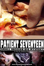 Watch Patient Seventeen Megashare