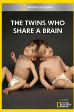 Watch National Geographic The Twins Who Share A Brain Megashare