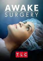 Watch Awake Surgery Megashare