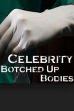 Watch Celebrity Botched Up Bodies Megashare